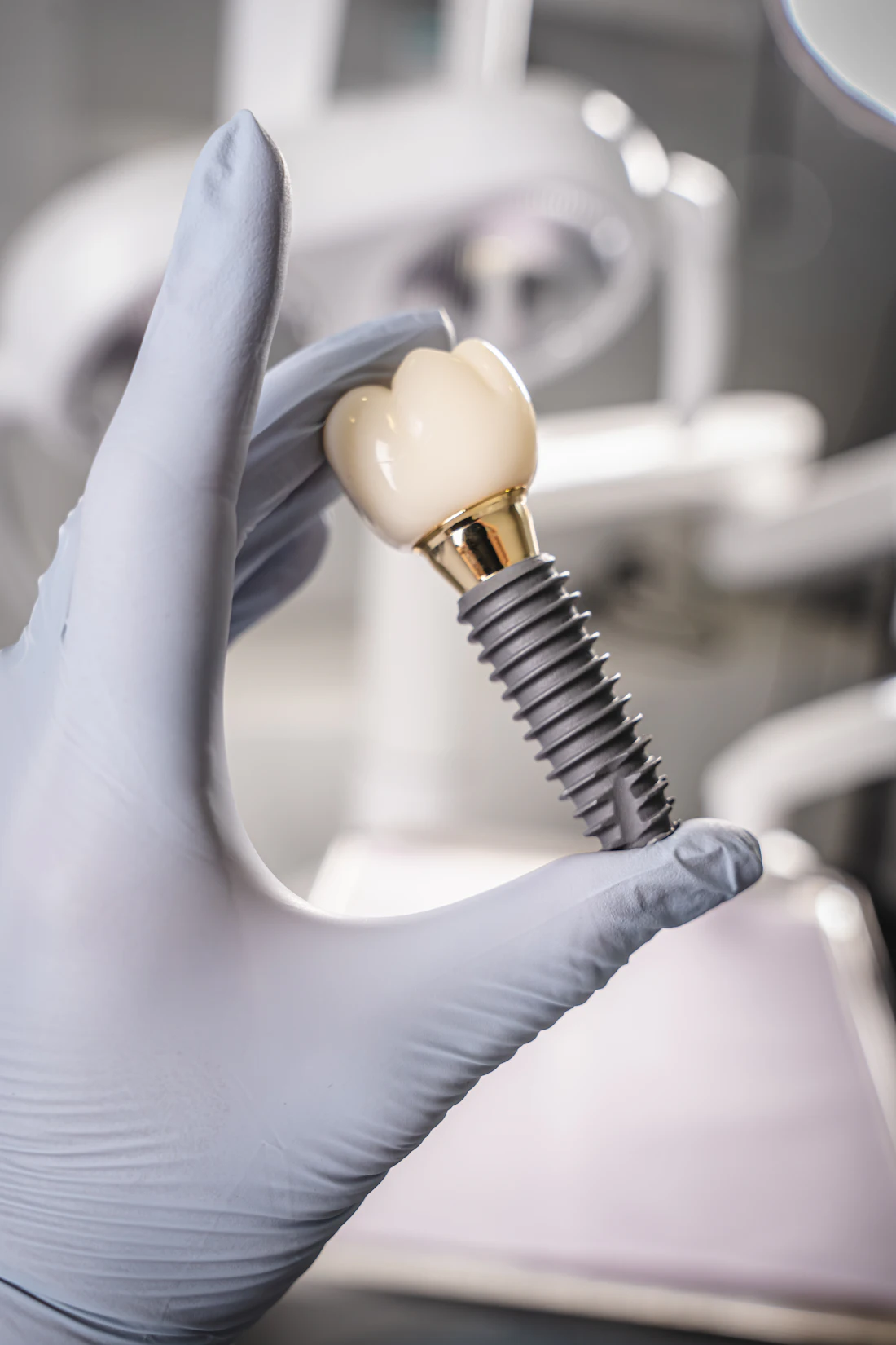 Implante dentário segurado por luva
