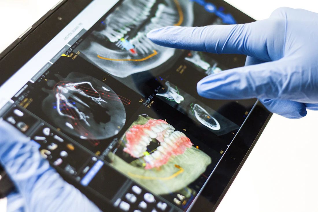 Tomografia da arcada em um tablet